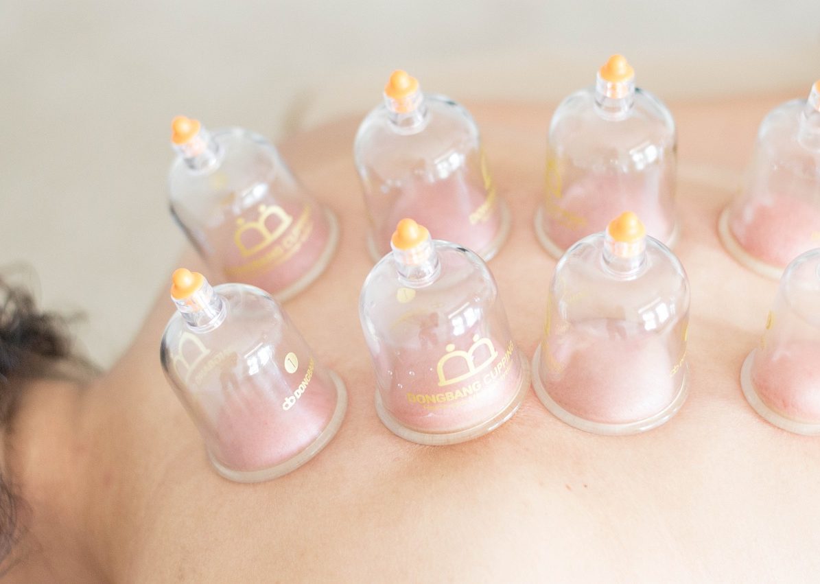 Schröpfen Schröpfen
Heilpraktikerin
Mareike Janßen-Gotowka in Bockhorn